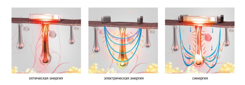 Аппарат Estetik Systems 4 в 1: SHR, Элос, Yag-лазер, РФ-лифтинг