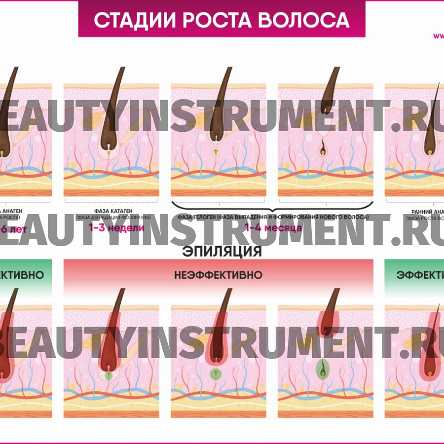Плакат А3 для косметолога "Стадии роста волос и эффективность эпиляции"